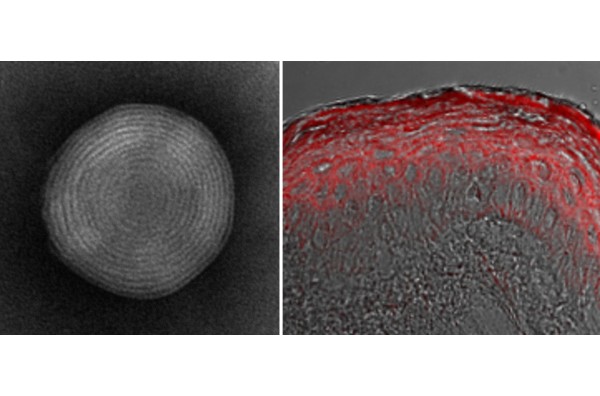水溶性成分を肌深くまでムラなく浸透させる「高親水性リポソーム」を開発<span class="filesize__info">PDF:520KB</span>